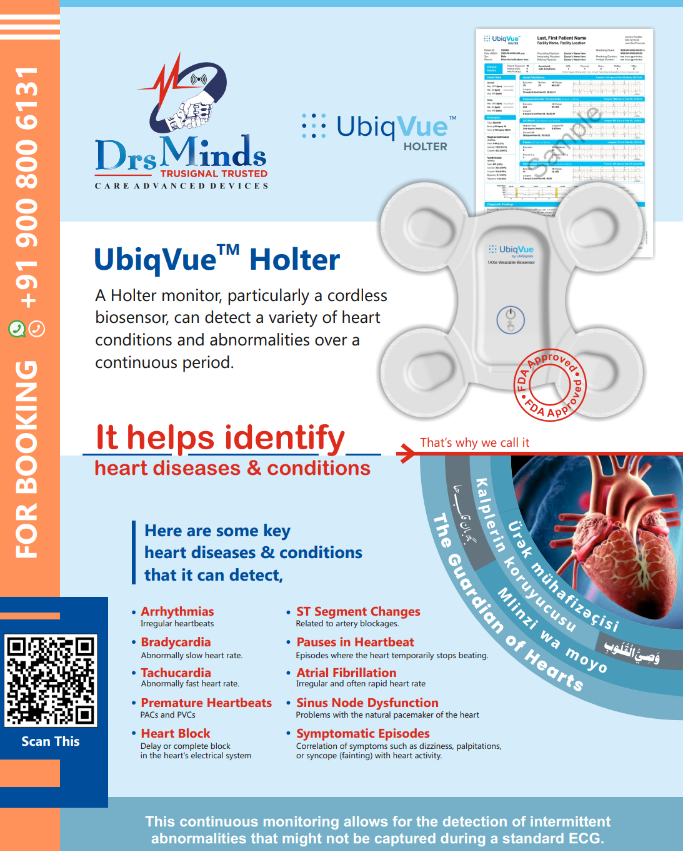 UbiqVue Holter ECG Monitor